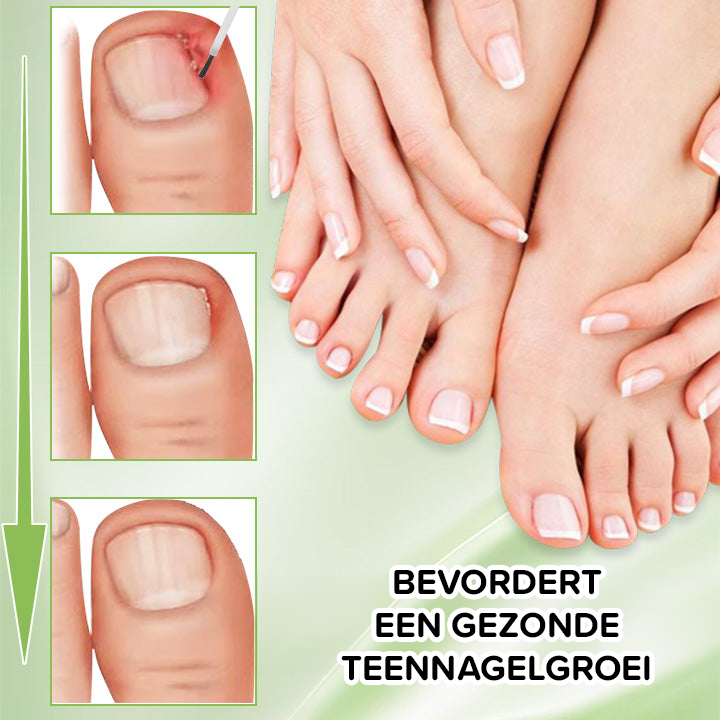 FungiFix Nagelschimmel Voedende Behandeling Vloeibaar