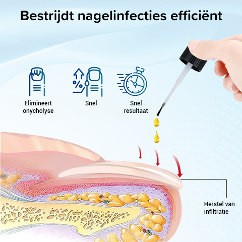 OnyxoGuard nagelgroei- en herstelserum