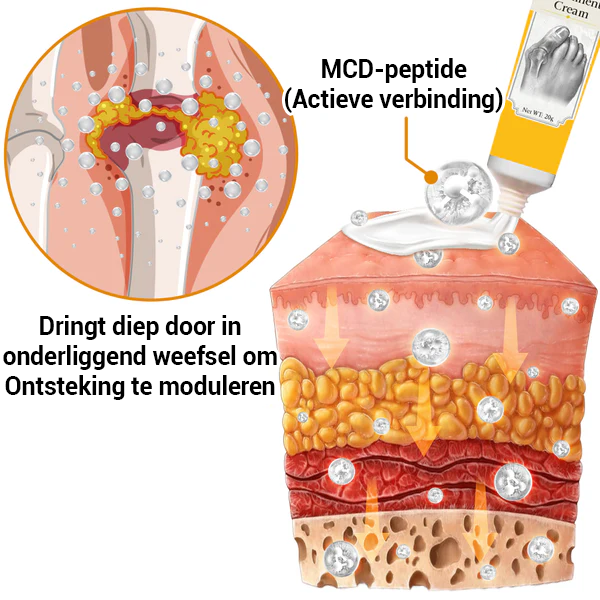 HalluxCare Bijengif Behandelingscrème