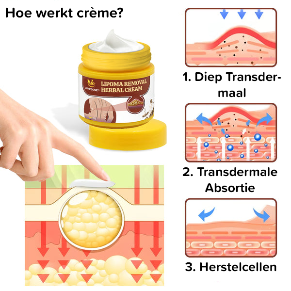 Lipoomverwijdering Kruidencrème