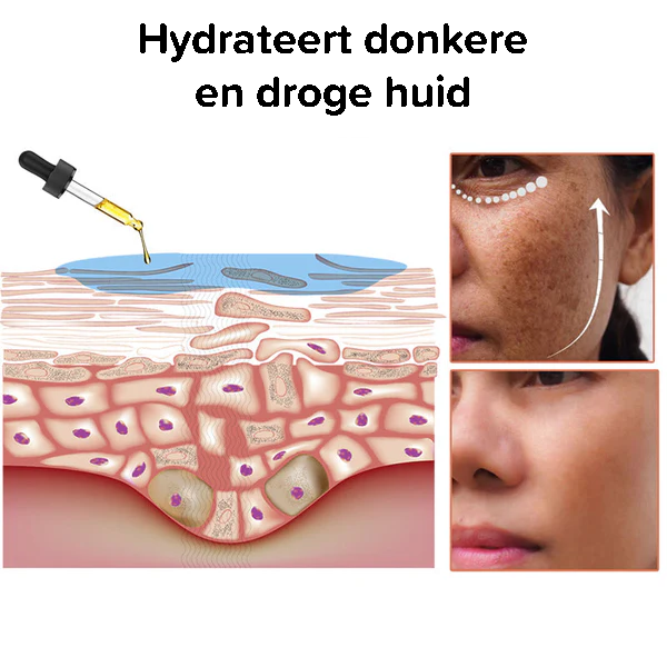 Snel Donkere Vlek Verwijderaar Melanine Corrigerend Gezichtsserum