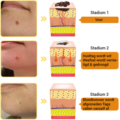 TagRecede Bijengif Behandelingsspray