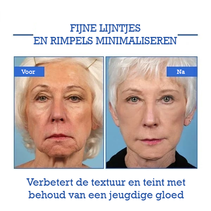 Botox Gezichtsserum